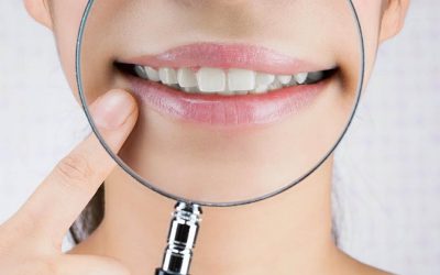 Sangrado de las encías: prevención y tratamiento