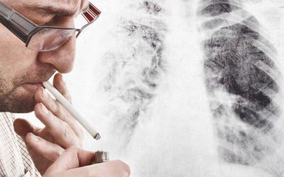 Tabaquismo y salud oral