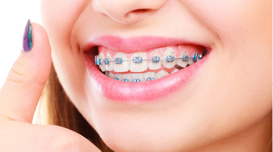 Qué es la ortodoncia
